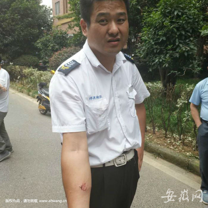 一名保安的手臂被咬傷。
