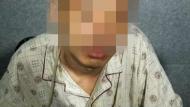 最“敬业”小偷！亳州24岁男子手臂骨折仍偷电动车