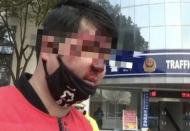 酒后駕駛摔花了臉  蕪湖男子： “腸子都悔青了” 