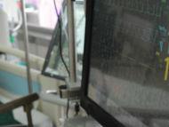 感冒引發臟器衰竭 “人工器官”救他命