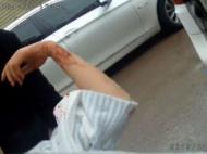 孕妇出租屋内割腕自杀 鲜血直流 颍州民警紧急救助