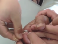 南陵一老人手卡鋼環 消防員2次往返醫院施救
