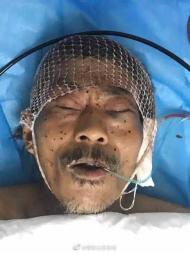 老人頭部受傷已被送醫  霍邱警方急尋其家人