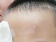 合肥：男童頭部鮮血直流 居委會(huì)大姐線上為其尋找家人