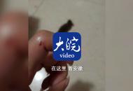 安徽一姑娘賓館睡覺 半夜竟被老鼠咬傷 驚恐之余掐死老鼠