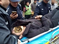 銅陵一男子為坐“霸王車”竟拔腿就跑 沒想到摔了一跤腿部骨折