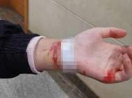 女孩和媽媽吵架后割腕輕生 民警火速趕到救援
