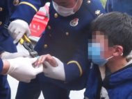 阜阳10岁男孩手卡异物 冷静打电话求助