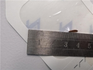 想說“取”你不容易！8mm銅絲貫穿眼球，安醫四附院醫生借助骨科利器保住男子視力