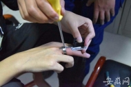 都是炫酷惹的禍！蕭縣2小伙被“開瓶神器”“咬手”