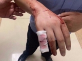 六安民警徒手砸破车窗  将车主从生死一线间救出