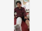 巢湖：夫妻下班出工地门口时摔伤，这责任该怎么算？