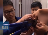 阜阳：为拍抖音男子戴上鼻环 拍完取不下来（视频）