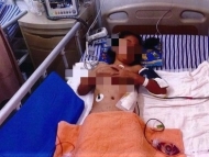 六安8歲女童在南昌一小區(qū)內(nèi)遭烈性犬撕咬  媽媽身上也被咬傷30多處