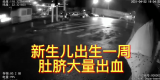 滁州一初生婴儿肚脐大量流血  民警及时营救