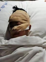 瘋狗連傷四人后被蕭縣民警擊斃  5歲男童受傷嚴重住院治療