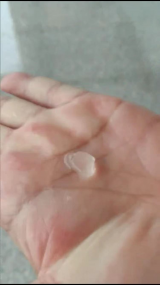 祁门县局部出现冰雹雨 