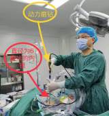 高位腰椎間盤突出致患者跛行 海醫骨科實施內鏡手術解難題