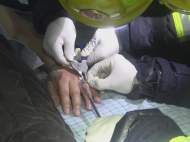 淮南：外賣小哥摔傷致手掌浮腫 消防人員幫忙取下卡手戒指