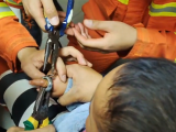 合肥一幼童手卡环形螺丝 消防到场后快速摘除