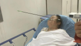 西安一女子小區散步時被弓箭射穿面部，多地曾發生類似傷人事件