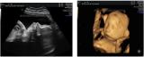金寨縣婦幼保健院超聲科積極行動(dòng)努力提升業(yè)務(wù)水平 守護(hù)孕產(chǎn)婦及胎兒生命健康 