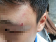 初二男生在學(xué)校被老師丈夫刺傷？湖南一學(xué)校最新回應(yīng)