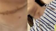 湖南女子遭丈夫割喉案一審宣判：被告人犯故意傷害罪獲刑一年半
