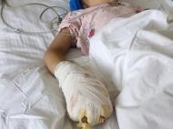 逼吃小米椒、把手按到滾燙熱水里、毆打……女童遭繼母虐待致殘