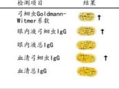 5歲男孩險失明或因玩寵物后未洗手
