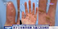首金背后是滿手厚繭 家鄉父老為健兒加油喝彩