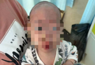 廣東一男嬰出生后被確診腦病，經(jīng)鑒定為醫(yī)療事故，當(dāng)?shù)囟喾交貞?yīng)