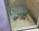 女子在大連一酒店洗澡時浴室玻璃炸裂致右腳肌腱斷裂？酒店回應