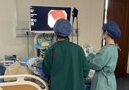 浙江一男孩腸道里查出20多顆“珍珠”