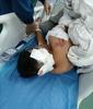 “压在身上乱咬”，湖南10岁男童遭阿拉斯加犬咬伤，事发三天仍在ICU内抢救