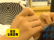 女子揉眼睛掉出蟲(chóng)子檢查取出60條蟲(chóng)