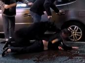 大黑狗咬傷一女子 湖南湘潭警方回應(yīng)：有接到報(bào)警 正在處理