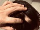 温州一家长称3岁男童寄宿在保育员家里却被虐待致伤   警方：涉事人已被控制