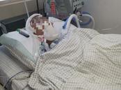 13歲男孩被同學打進ICU，國內頂級醫學專家稱搶救難度極大！