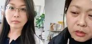 “斷崖式衰老”是真的？42歲女子容貌變得像70多歲 專家：男性或更早