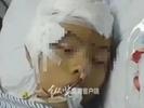 广东一中学生疑被打成植物人，警方回应