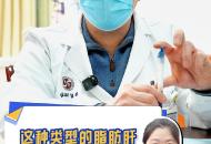 這種類型的脂肪肝建議做磁共振檢查