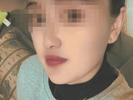 四川凉山一女子被丈夫泼白酒点火致大面积烧伤？当地妇联：已介入，双方都有问题
