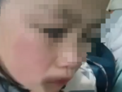 江西一家長稱孩子因做錯題被老師打紅臉，學校：手有碰到臉，教育局介入