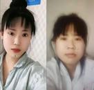 24歲女孩花21萬元整形出院當天自殺，醫美機構：無直接關系