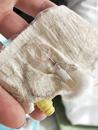 紧急求助！陕西一男婴输液时针头导管留在体内，家属称5年后已流动至颈部 