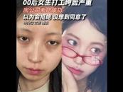 南京00后女生打工垮臉，公司賠了萬元“顏值折損費”，還放了3天美容假