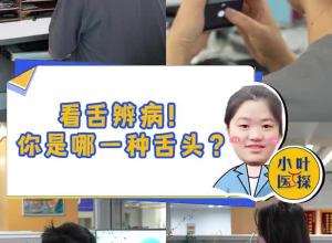 看舌辨病！你是哪一种舌头？