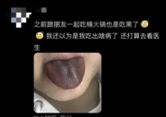 網(wǎng)紅火鍋店吃完舌頭變黑？官方通報：涉事店已關(guān)閉 