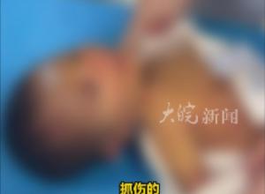 姑姑称新生儿被生母打伤住进ICU 
网信办：孩子目前已无大碍 
母亲有智力残疾，警方已立案